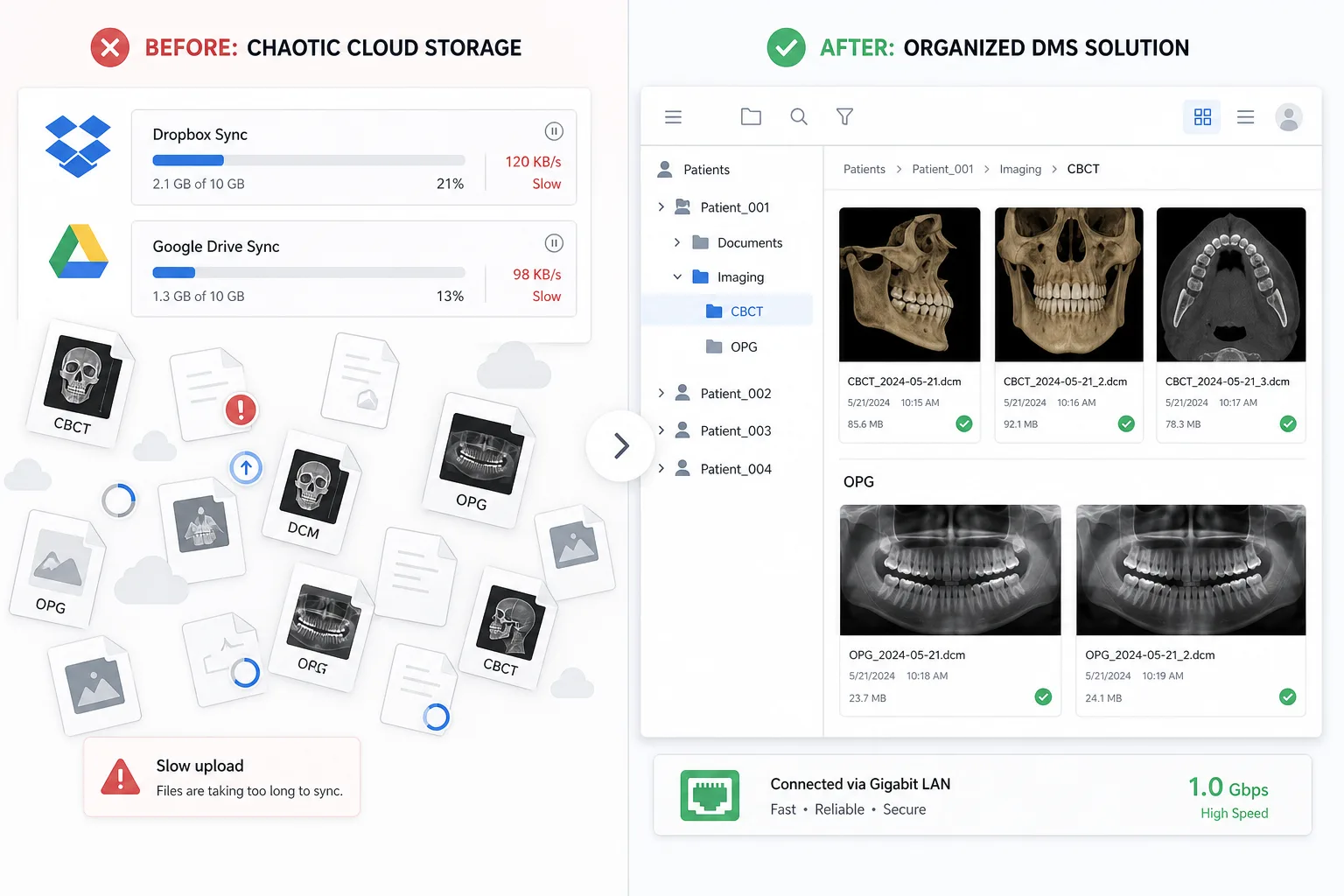 Before and after comparison of chaotic cloud storage sync versus organised OceanDMS patient imaging folders with CBCT and OPG thumbnails